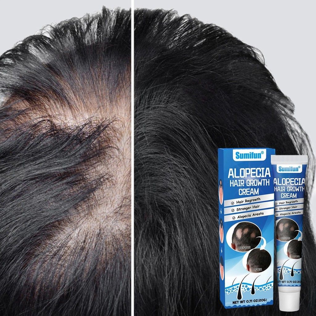 Crème Repousse Cheveux Anti-Chute
