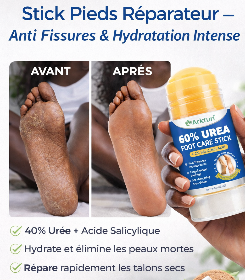 Crème Pieds 40% Urée – Répare, Lisse & Hydrate