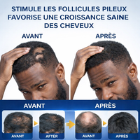 Crème Repousse Cheveux Anti-Chute