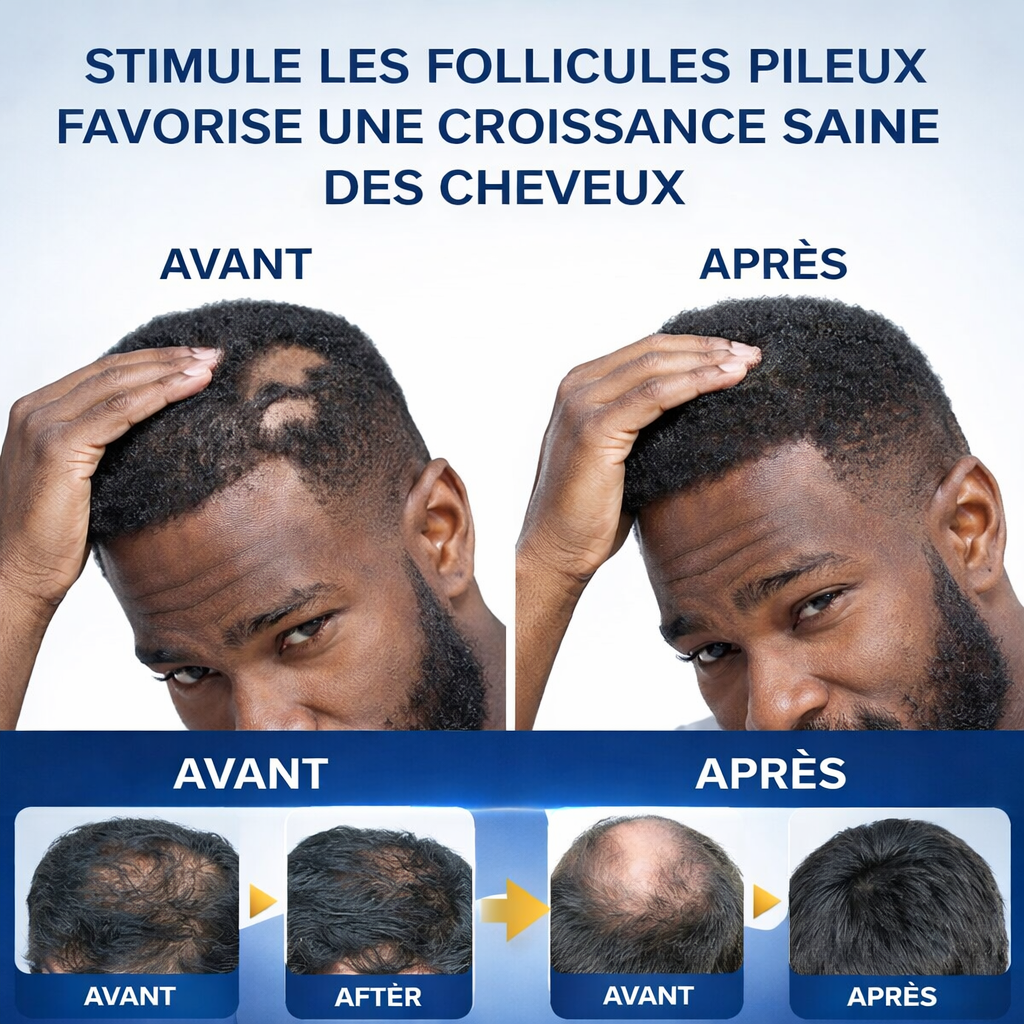 Crème Repousse Cheveux Anti-Chute